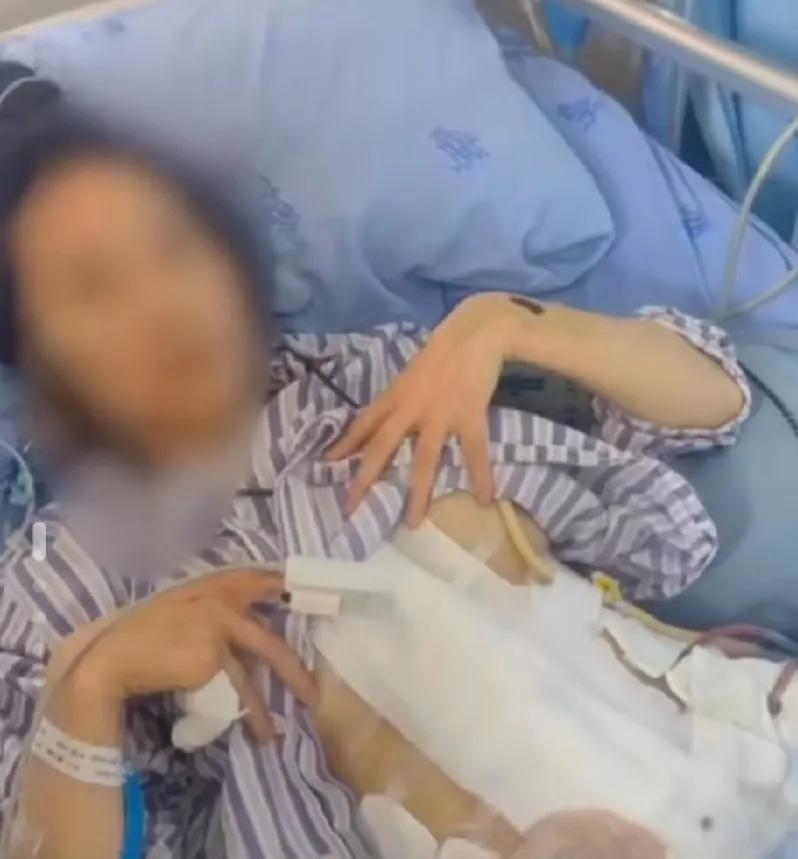 女子结婚2年被老公家暴16次，多个内脏受损，需终身挂粪袋，老公已被刑拘。

谢女