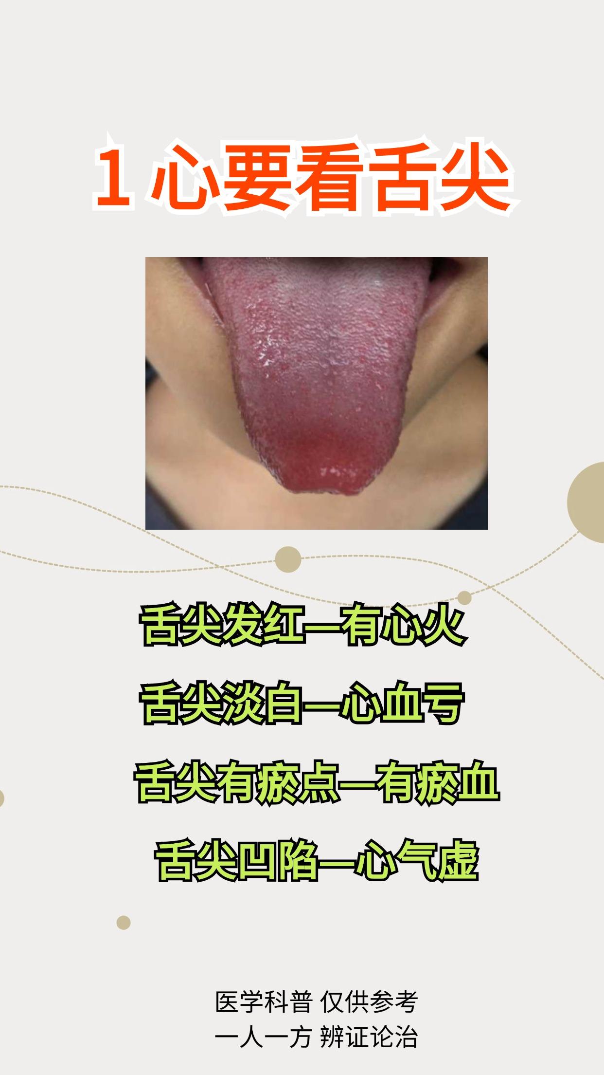 五脏好不好，一看舌头就知道！你的舌头有这些表现吗？

#中医# #健康科普# #