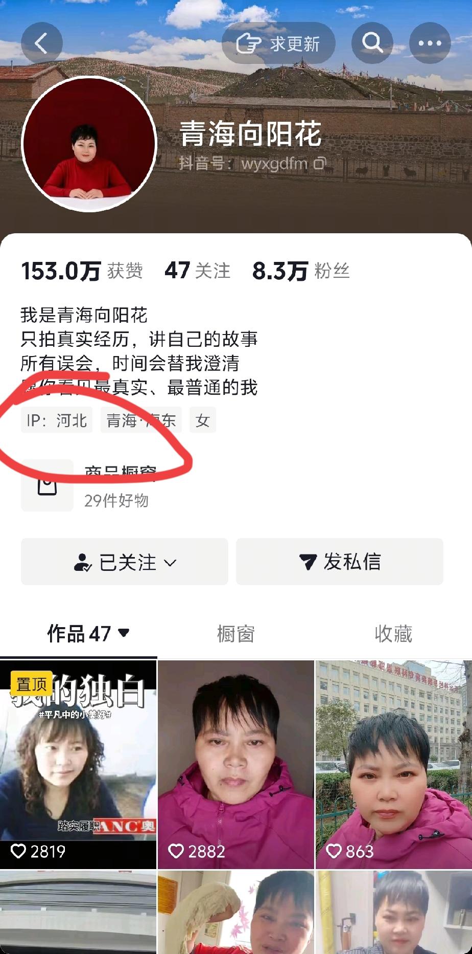 都让哑叔急死了，向阳花阿姨在河北邯郸，他是来这里查体的，是来这里写道歉信的，哑巴