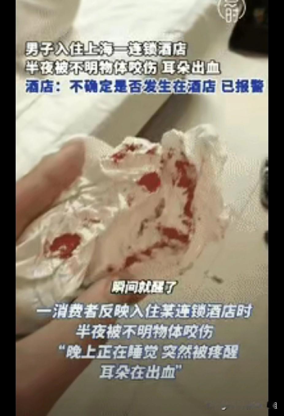 “倒大霉了！”上海一男子半夜在酒店休息时，突然感觉有东西在咬他耳朵，男子猛地张开