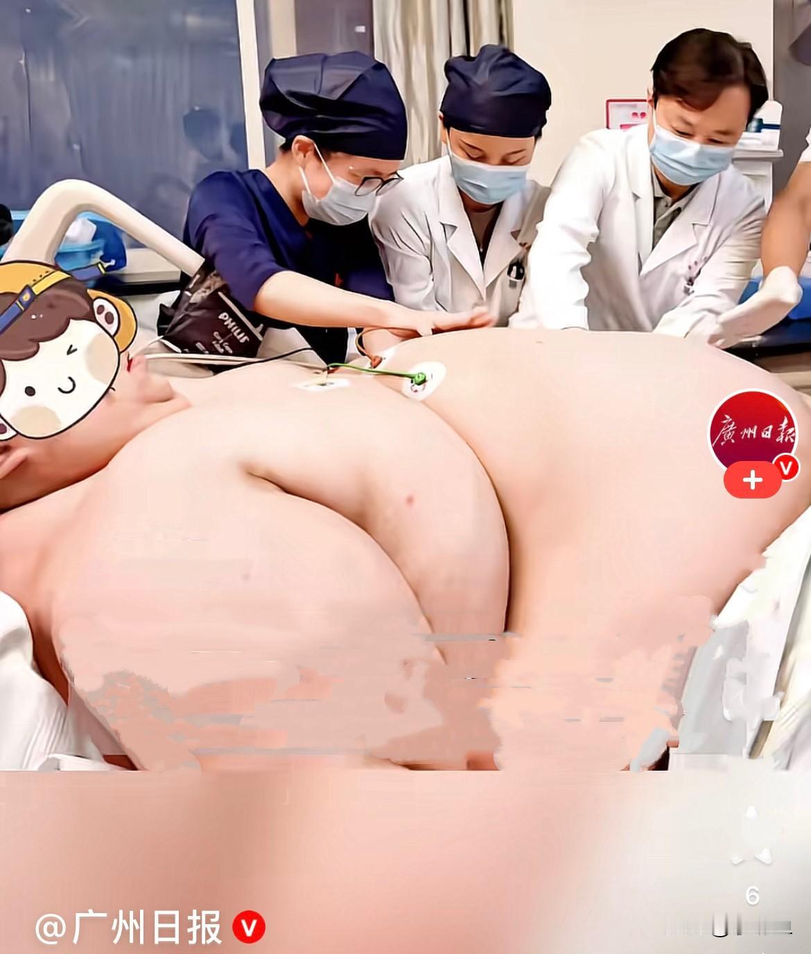 近日，一则新闻看得人心里沉甸甸的，30岁的晓洲，身高1米88，体重高达635斤，