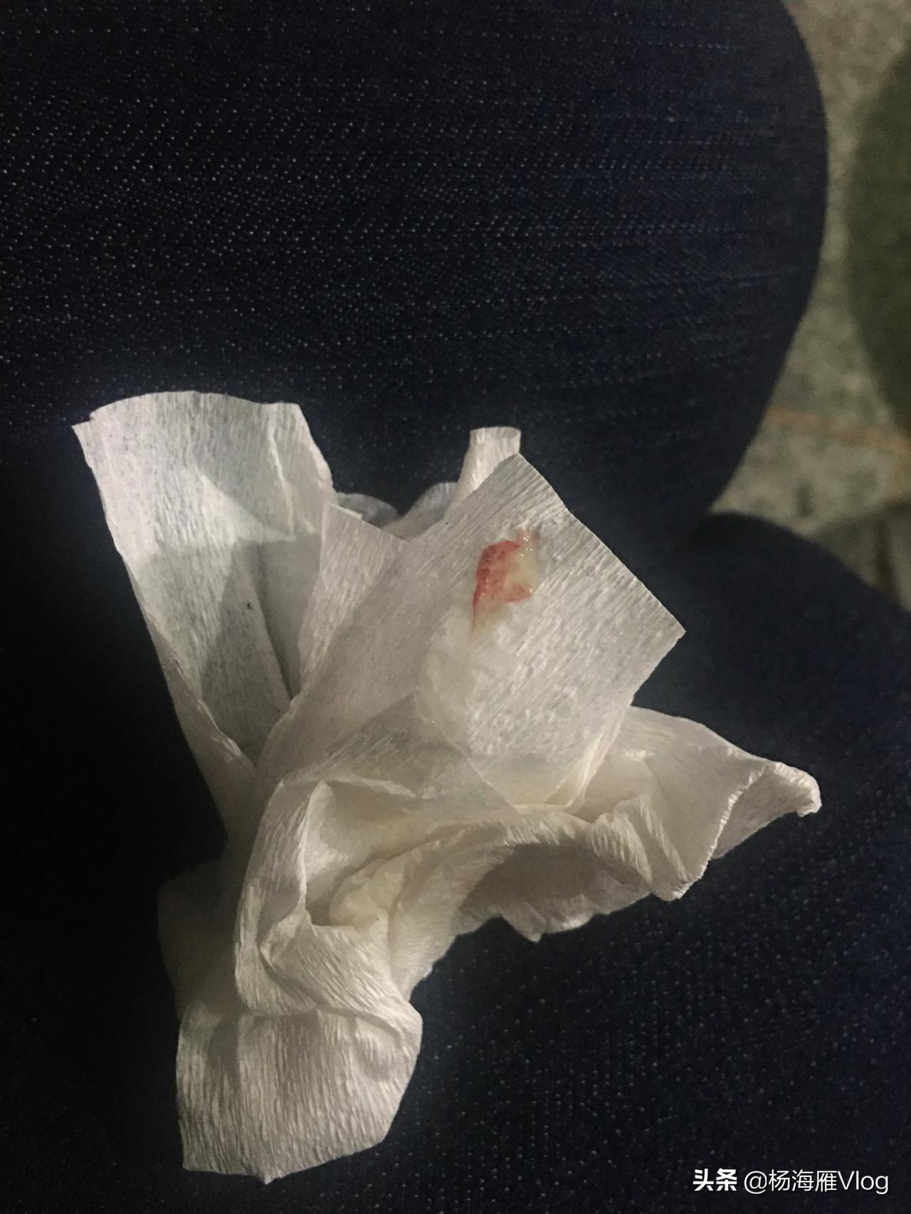 感冒发烧流鼻涕第四天，医院看病太贵为了多赚点钱坚持上班，今早起来咳嗽了十几分钟，