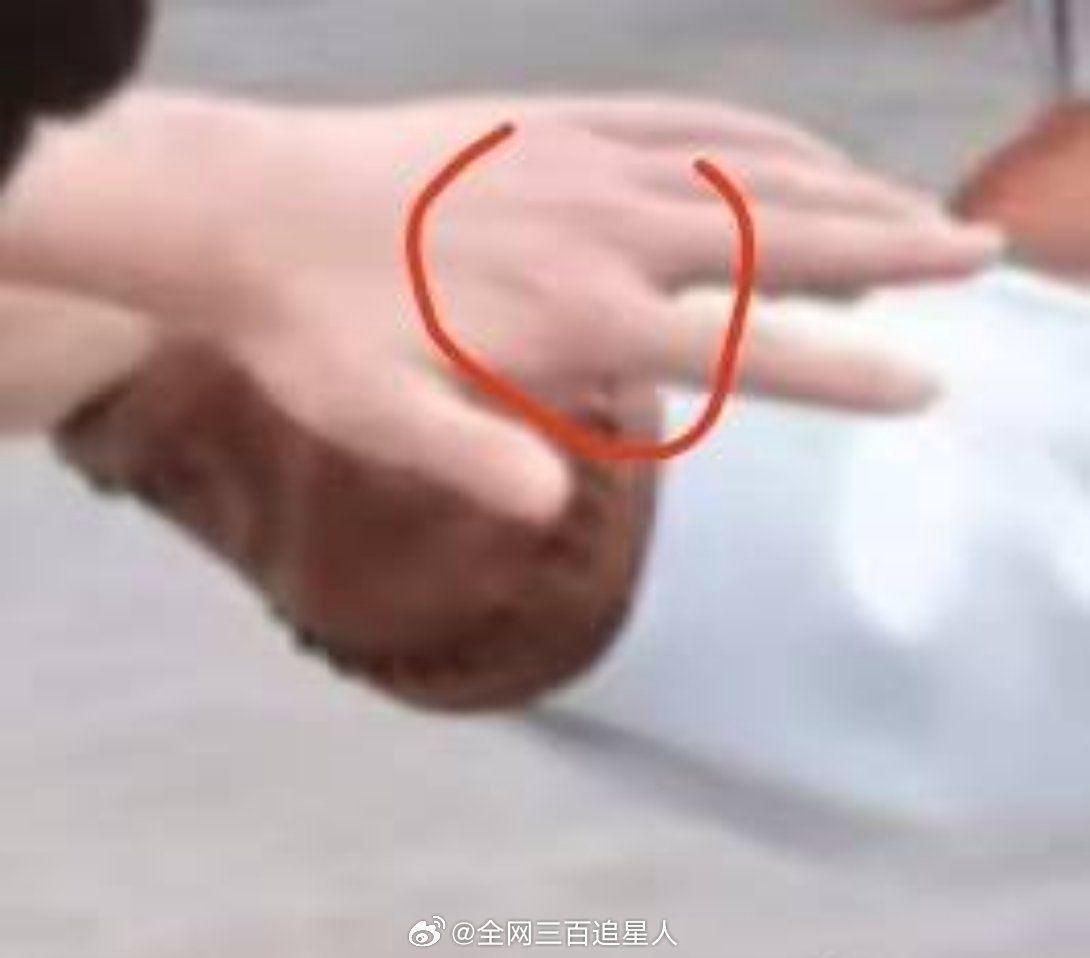 🚾杨洋这不让江山拍的，手又受伤了，看着好严重啊😦 