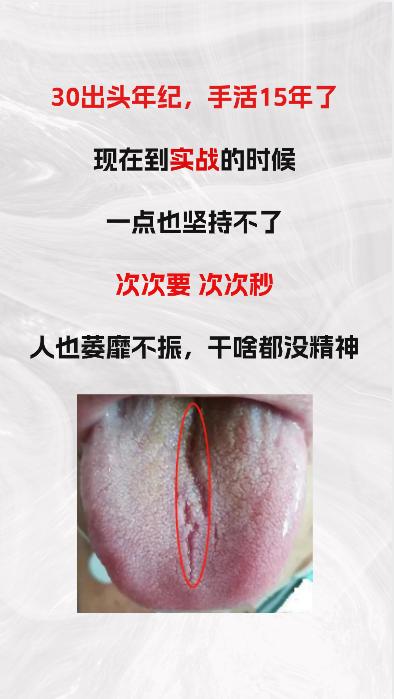 30多岁的年纪，手活15年，导致现在一到实战，就不行，次次要，次次秒！

#中医