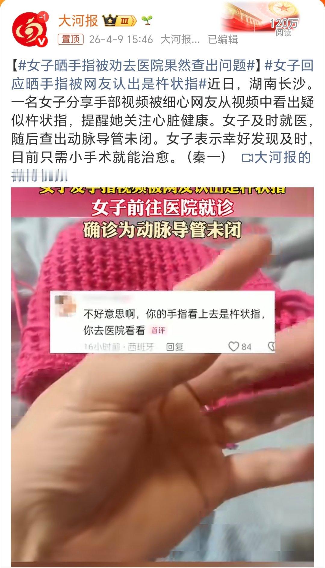 女子晒手指被劝去医院果然查出问题这介网友太厉害了！居然只看晒出的手指就能看出点健