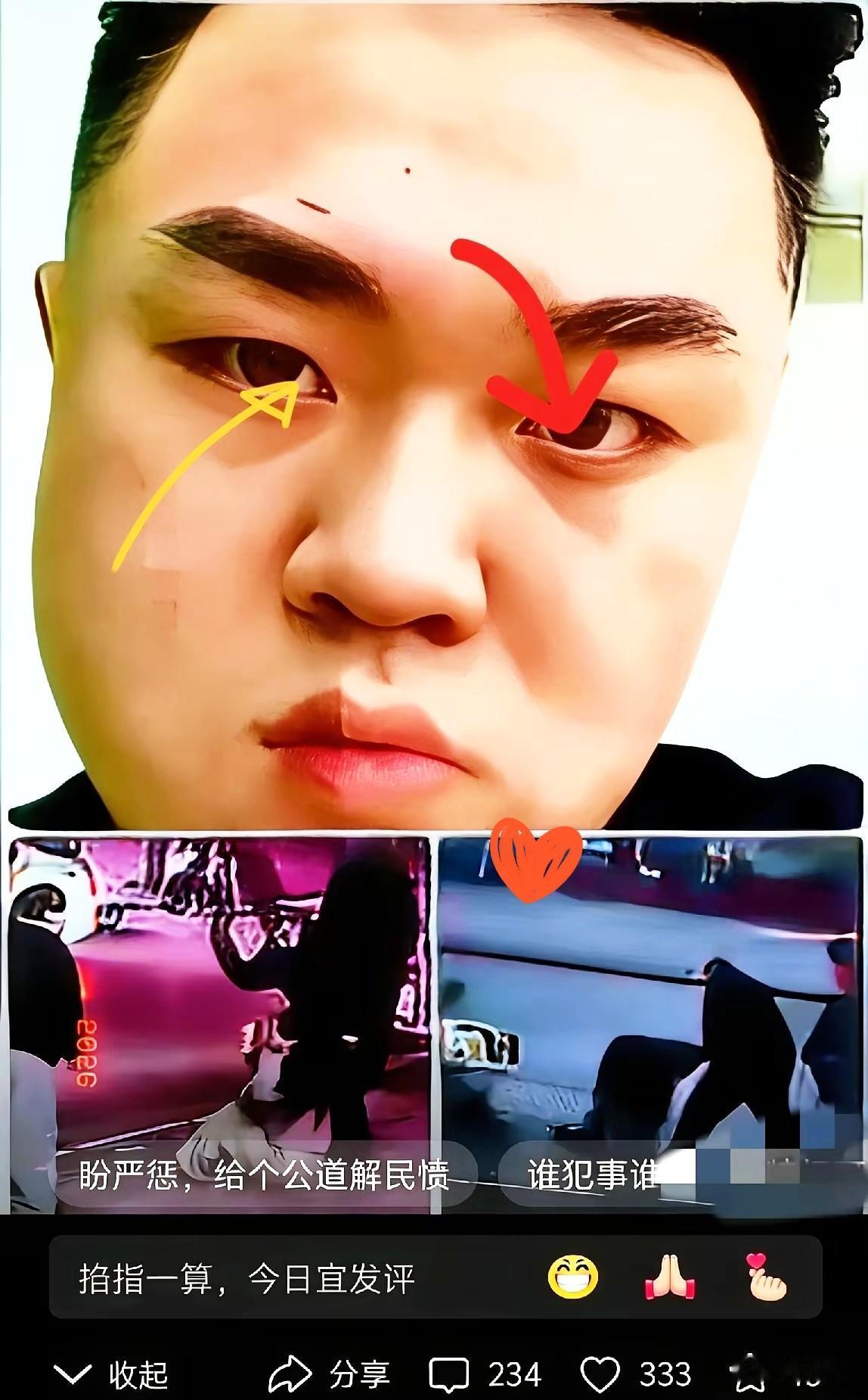 这俩货现在是真急眼了，
据说满世界找关系，
打算拿钱把这烂摊子给平了。我就想笑，