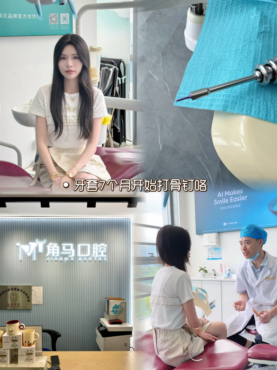 你们打骨钉什么感觉？痛😖？