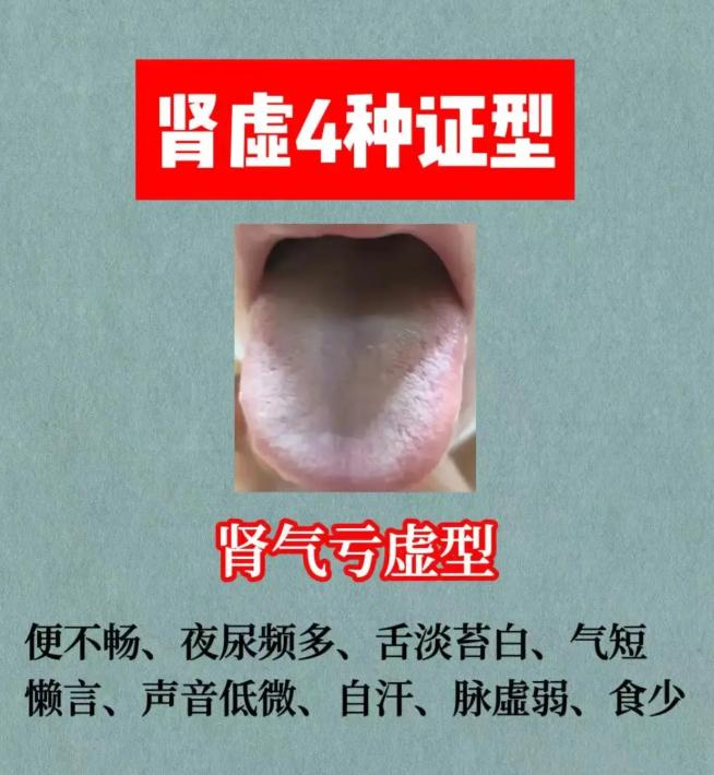 从舌象和症状，区分肾虚的 4 种证型