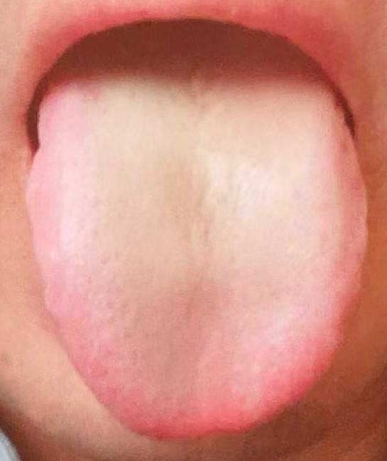 身体状态不佳？中医通补兼顾，稳步恢复底气







有不少朋友行事的时候，经