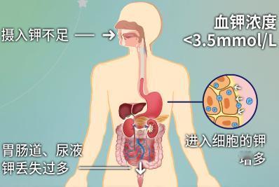 长期吃降压药的人，身体若有5个表现，或是“缺钾”了！注意补充

在一个阳光和煦的