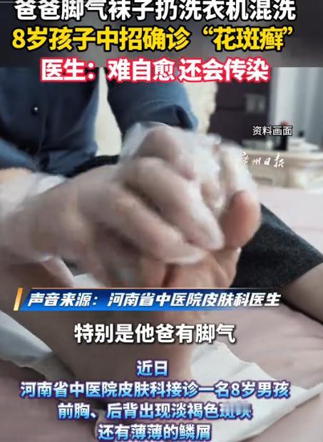 出事了！8月18日齐鲁壹点消息，河南一名8岁孩子前胸后背冒出不少淡褐色小斑块，上