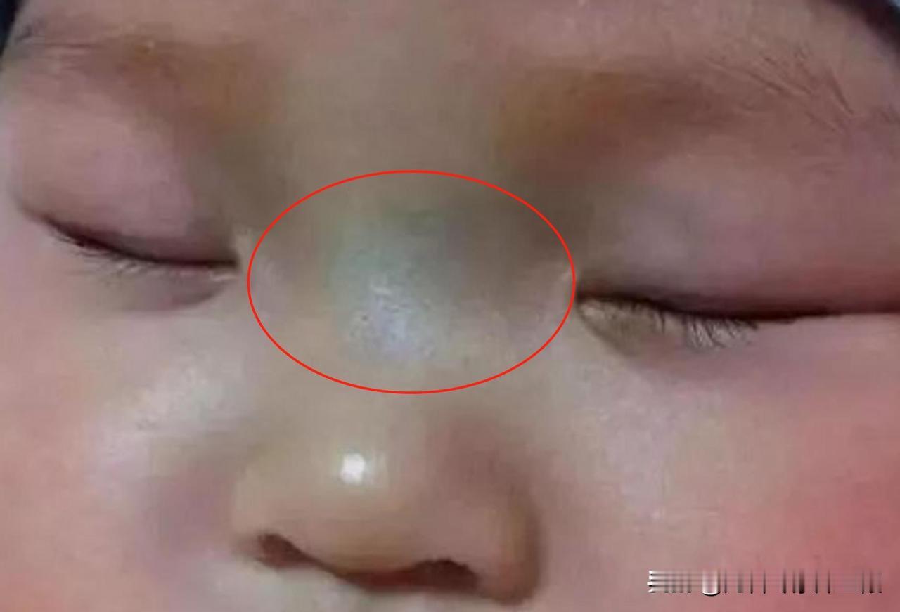 孩子脾胃好不好，从脸上就能看出来
 
1、轻度积食现象
孩子可能食欲不如往常，且