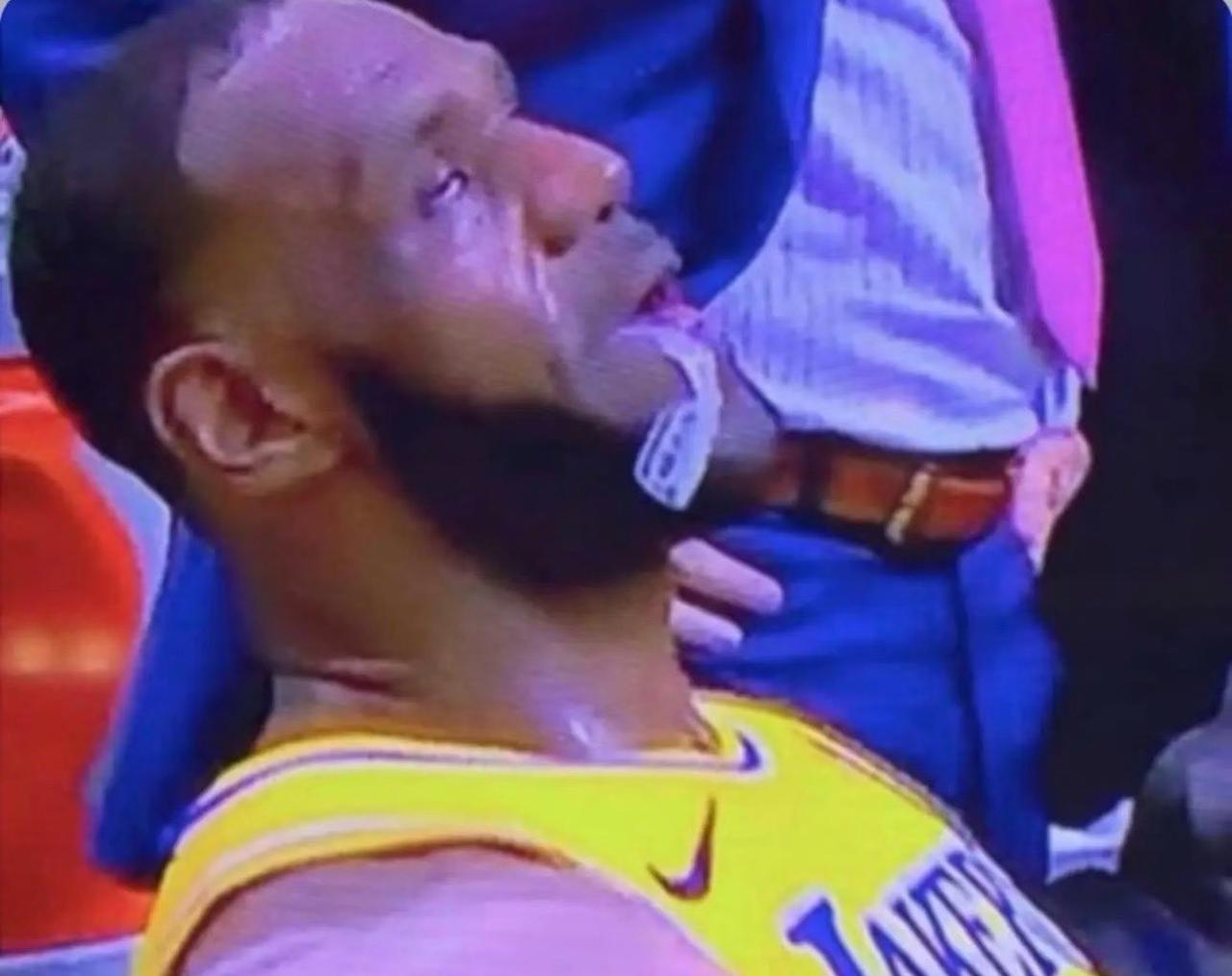 本轮系列赛真实缩影，詹姆斯把自己燃尽了🫡
记者：“你感觉好吗？”
	
LeBr