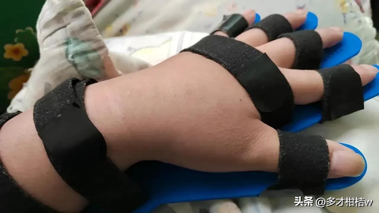 #我们应该活在当下还是展望未来#活在当下吧，作为一个脑出血患者，哪还有未来可讲？