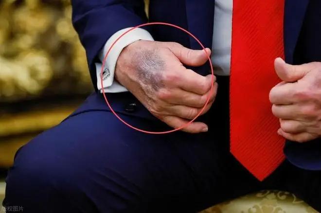 不管特朗普去世的消息是真是假，可以肯定的是，他的健康状况已经出了大问题。
 
白