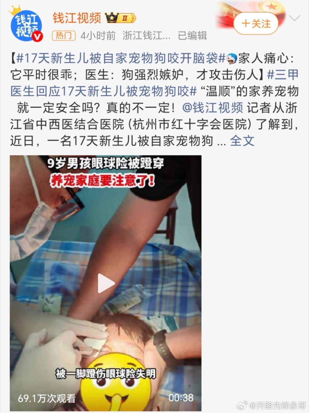 养了多年的狗突然咬破新生儿脑袋家长呢？