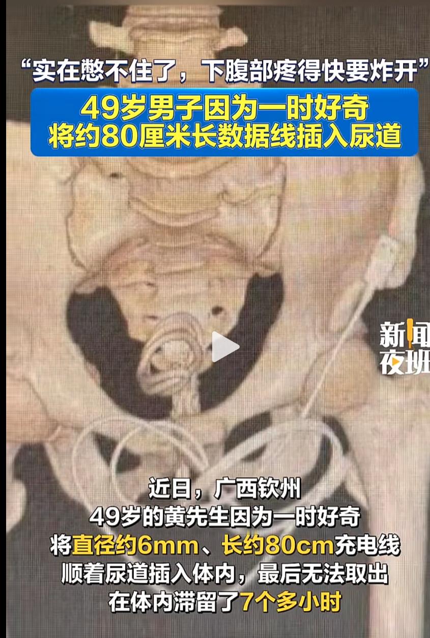 赛博格一集 
