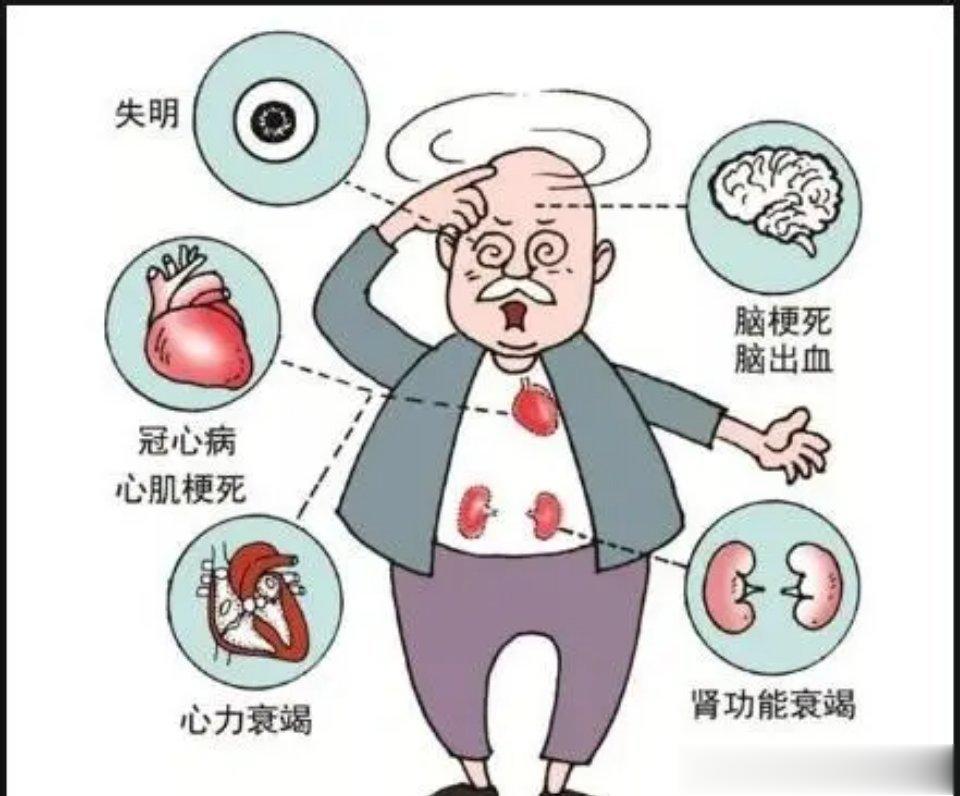 十几年的高血压，心情越来越差。高血压最严重的还是并发症，像高血压性心脏病，脑出血