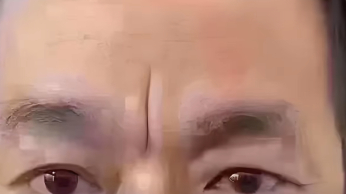 悬针破印堂，既额中间有一条竖纹。        印堂若有一道竖直的皱纹，会导致主