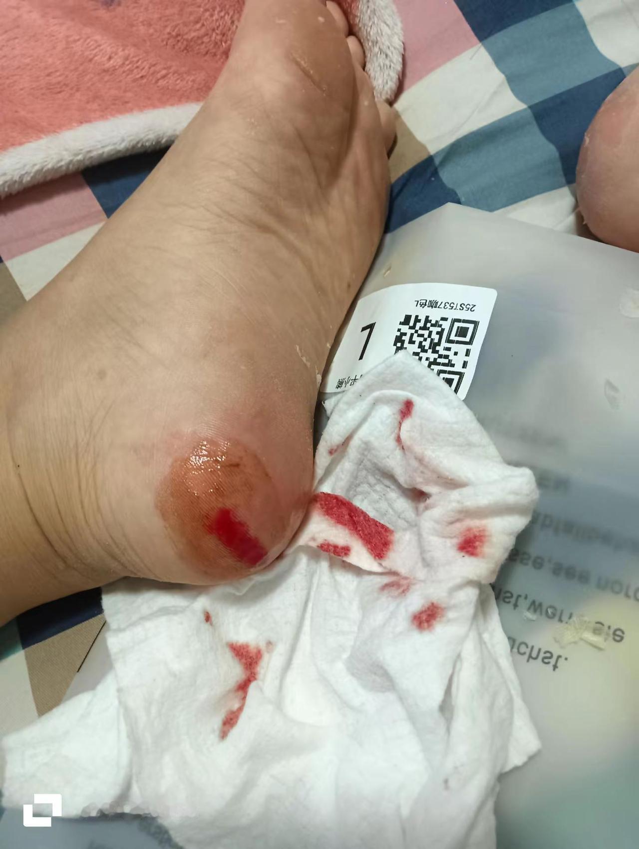 这么大的伤是不是得去三甲医院看看