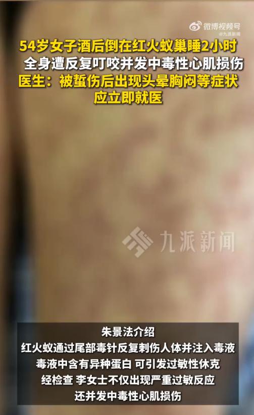 泉州 54 岁的李女士怎么也没想到，一次酒后失态，会让她在"鬼门关"前走了一遭。