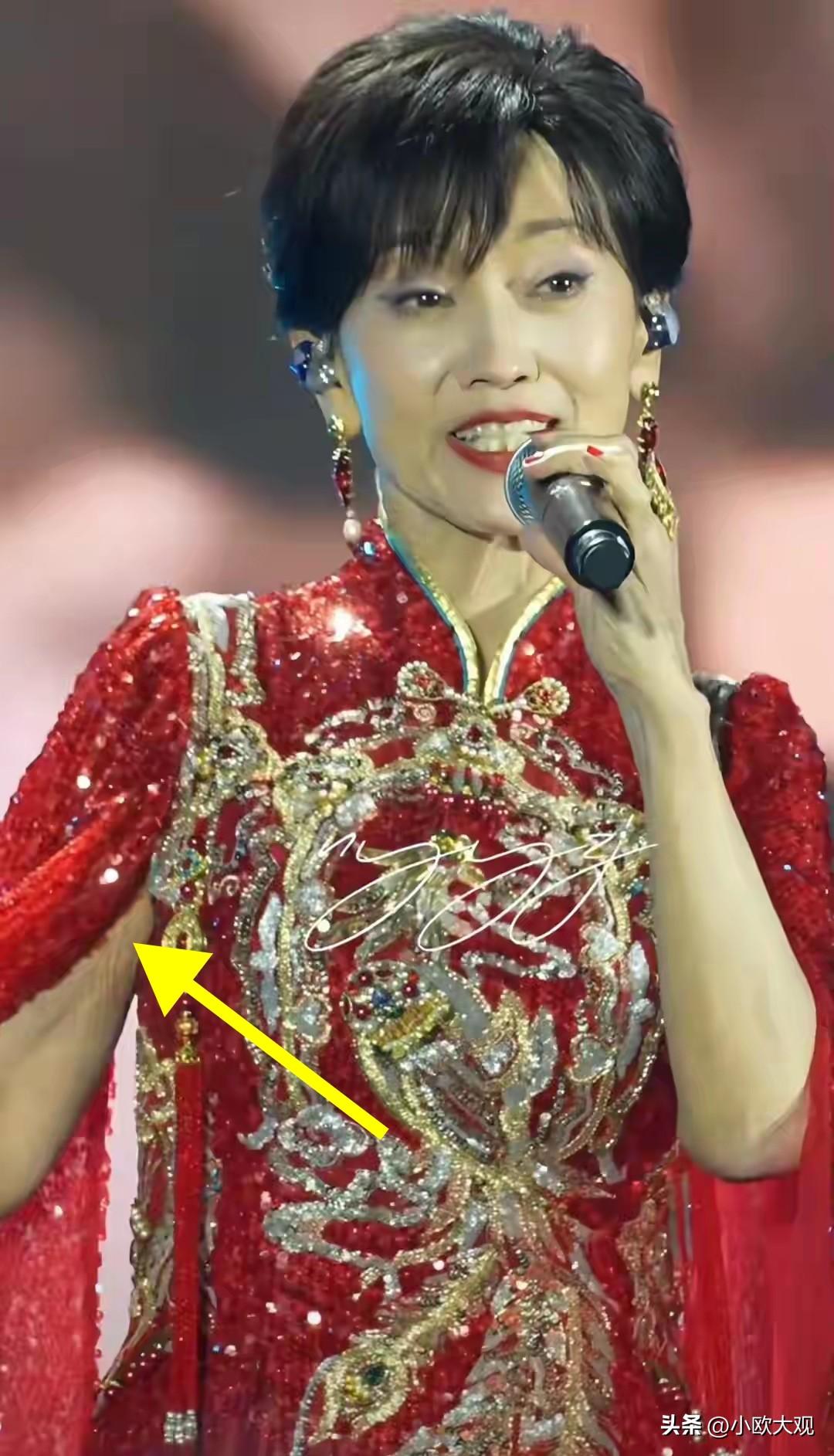 最近，赵雅芝上演的一张生图火了，大家都盯着她的腋下看。

3月21日晚，赵雅芝在