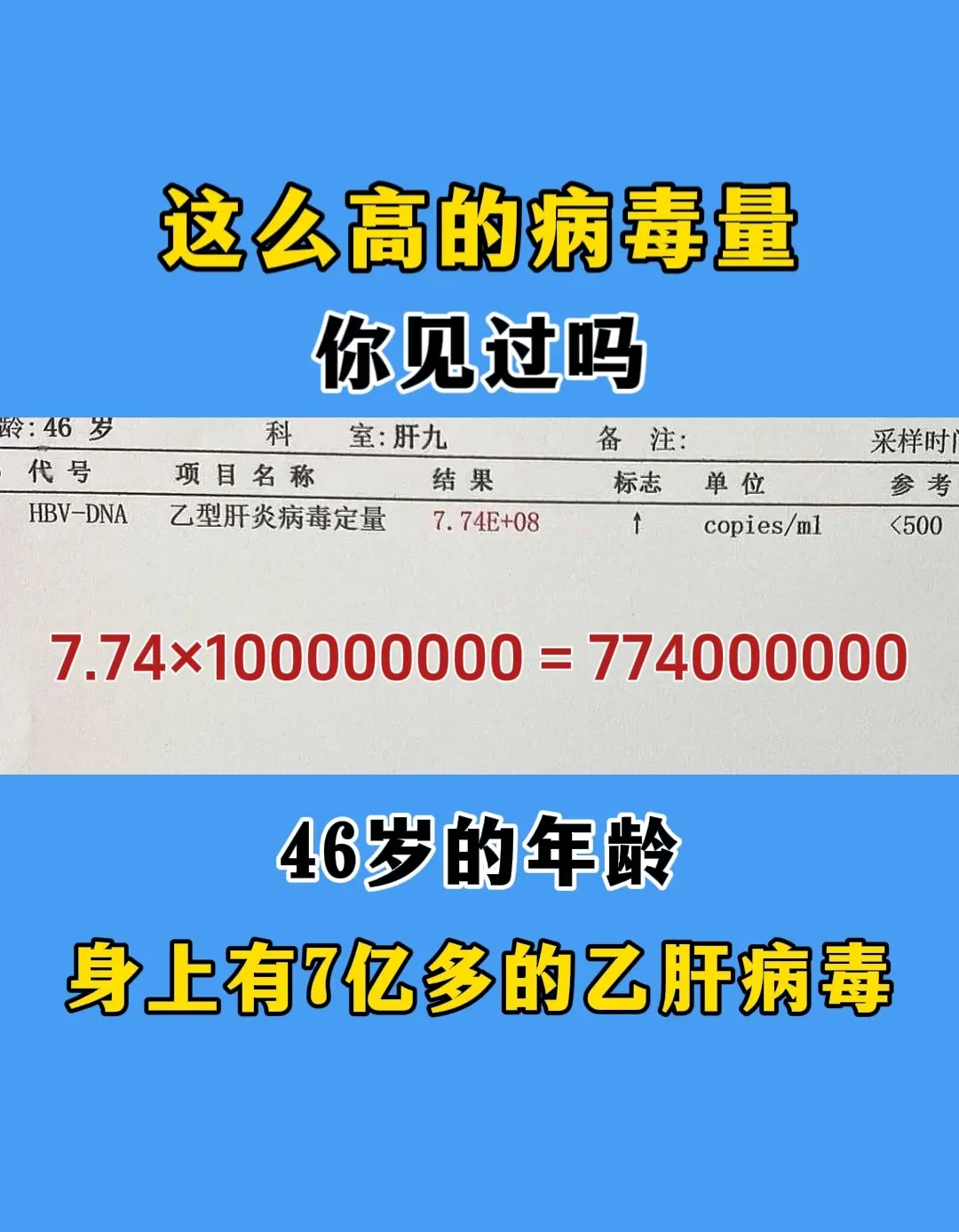 你见过这么高的病毒量吗。这是上午遇到的比较严重的患者了，46岁，每毫升...