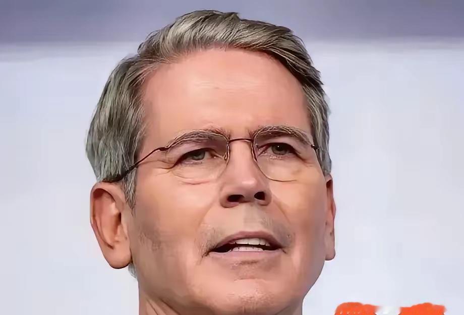 美国财政部居然亲自扎进现货市场，低调买入了阿根廷比索。要知道现在1美元能换140