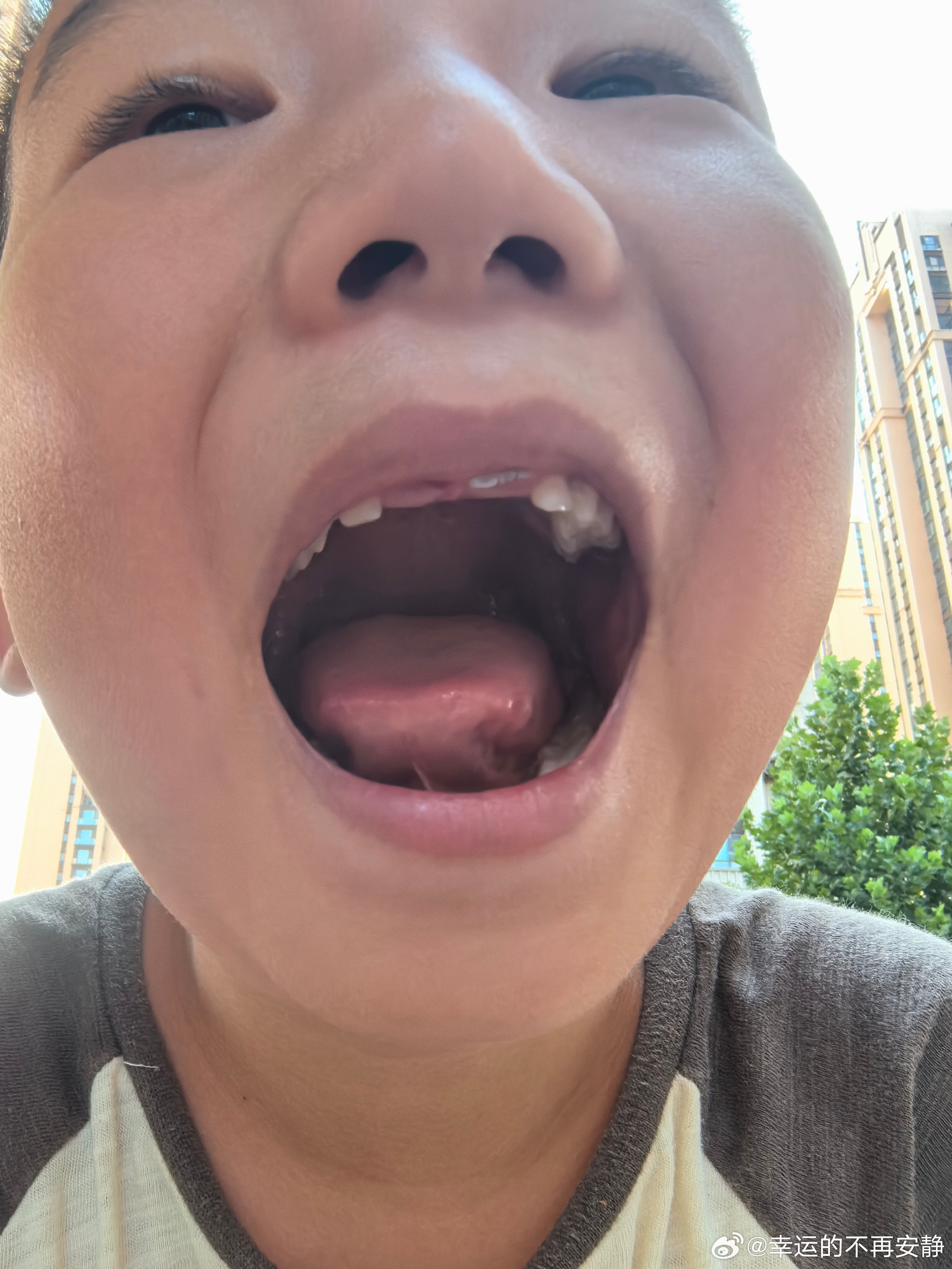 日常生活 记录一下今天儿子的大门牙又掉了一颗，距离上次掉快一个月了。上次是在老家