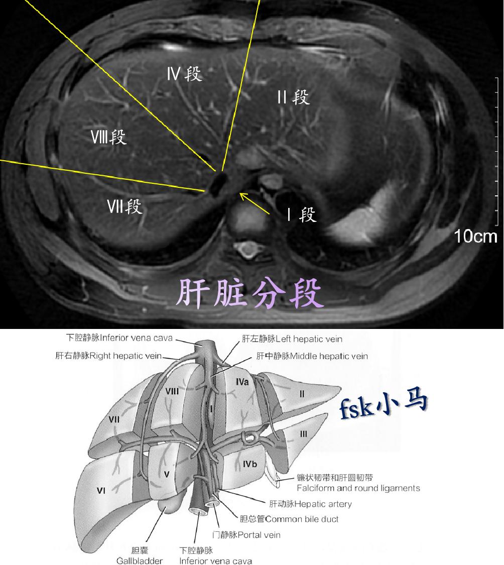 分段原则是：门静脉将肝脏分为上下两部分；胆囊窝顶点和腔静脉连线将肝脏分...