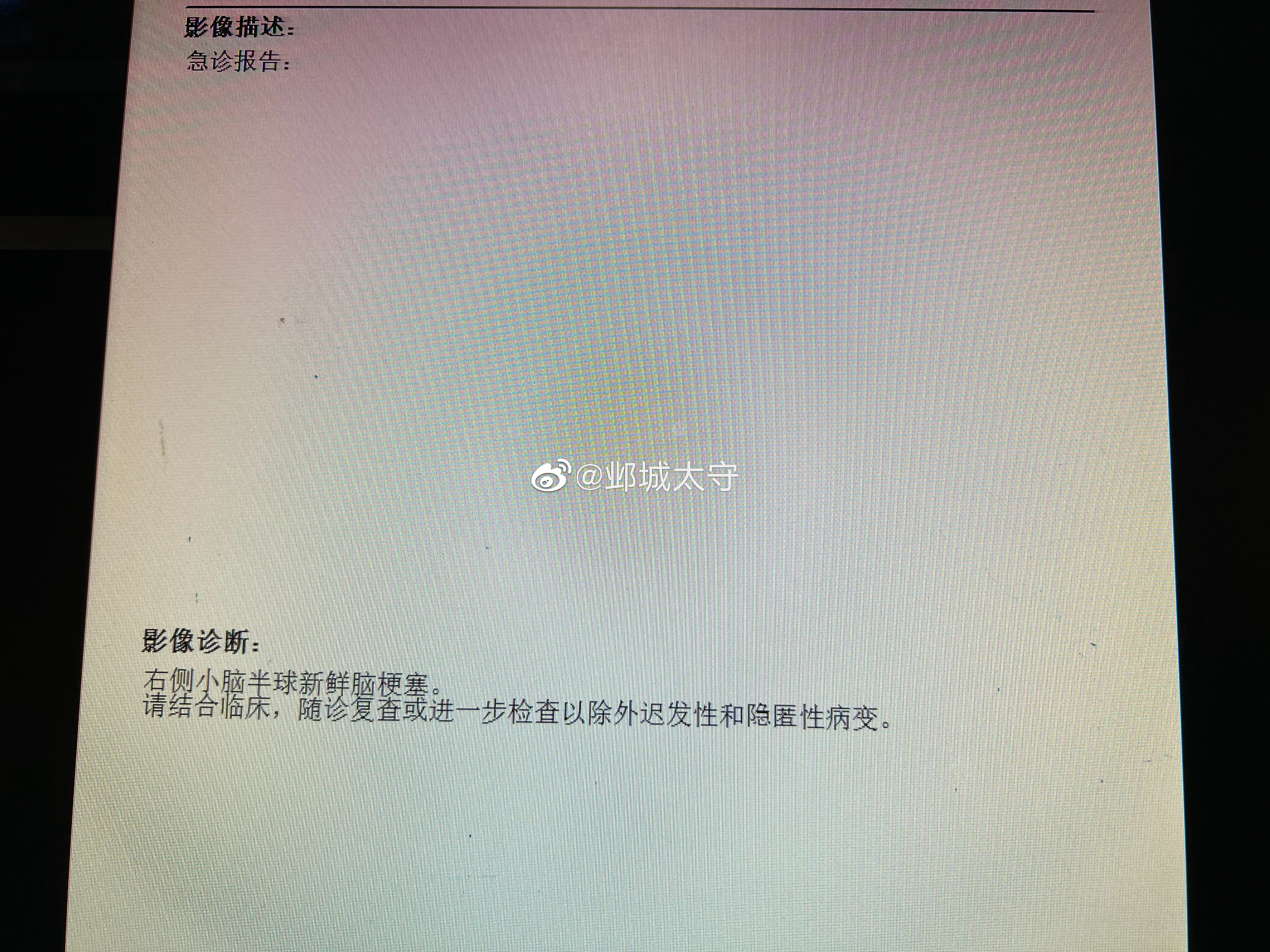 又收一例后循环缺血的。 ​​​