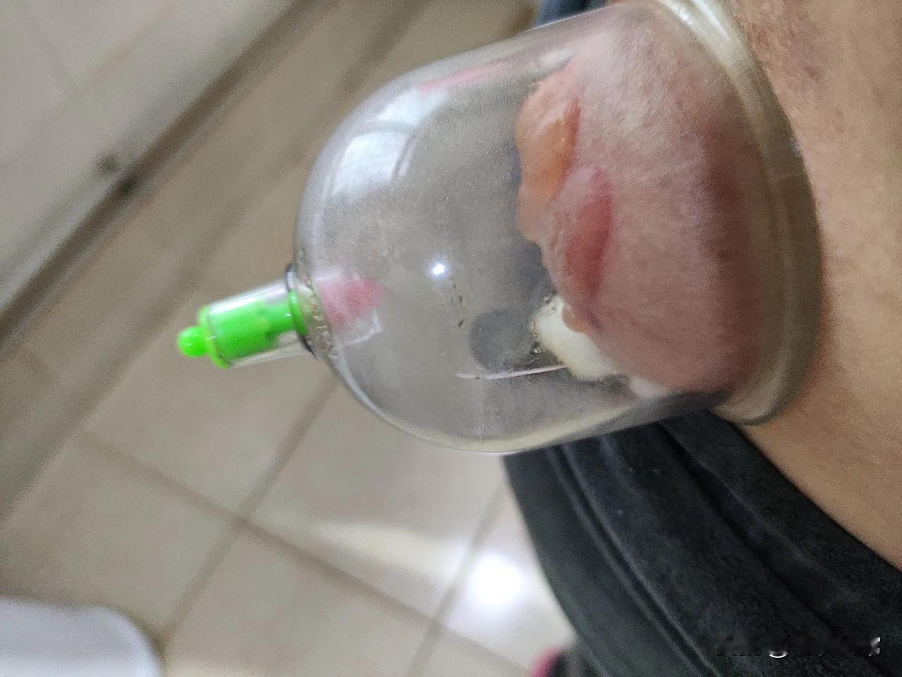 最近我的腰间盘突出，酸胀痛难受，走路腰直不起，去医院看，花了钱也没效，没有办法，