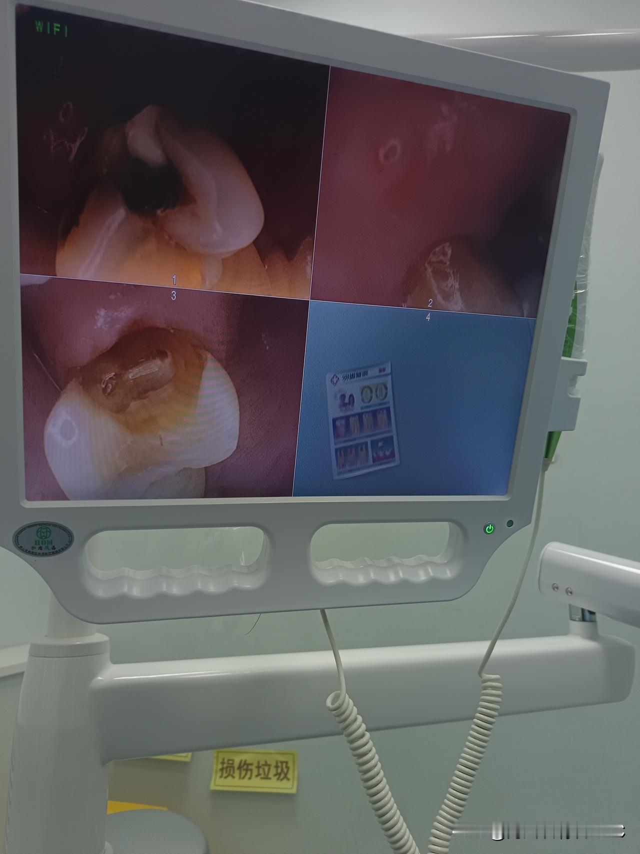 第一次牙不疼，主动去牙科门诊看牙。从小到大有过好多次，牙痛，看牙的痛苦经历，听到