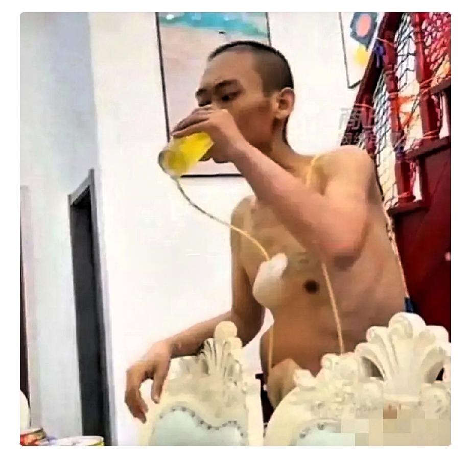 死看淡！重庆一名肺癌晚期男子，不想再治疗了，直接买了一箱啤酒。他身上还插着管子，