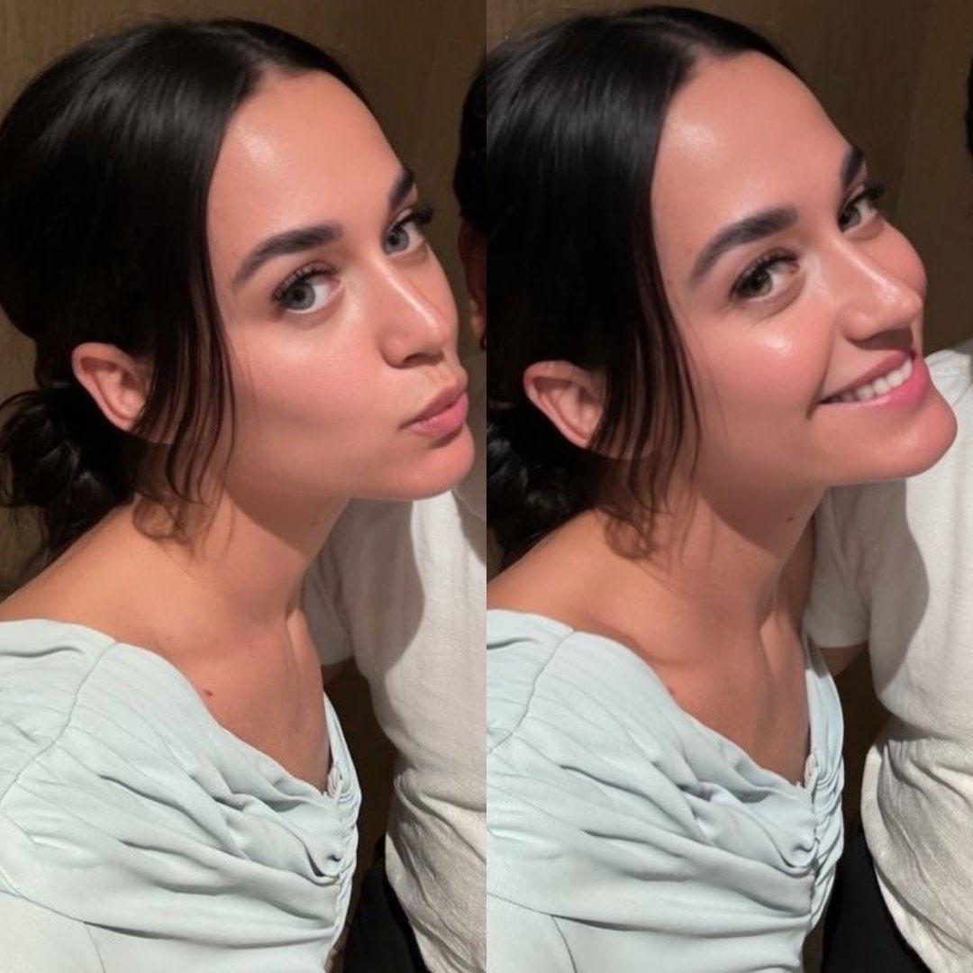 凯蒂·佩里真的逆生长了