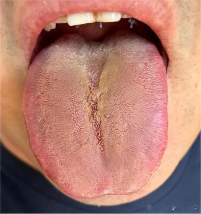 说了多少遍别盲目健脾，不听劝，再补十年你还是这样！

这位粉丝简直要把人气死，说
