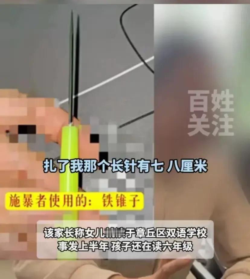 “我真的想死在学校里面！”山东济南，一家长发现自己女儿的校服上面全是针孔，掀开衣