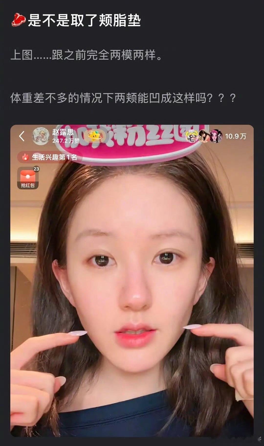 赵露思的脸和鼻子看起来为什么歪了 