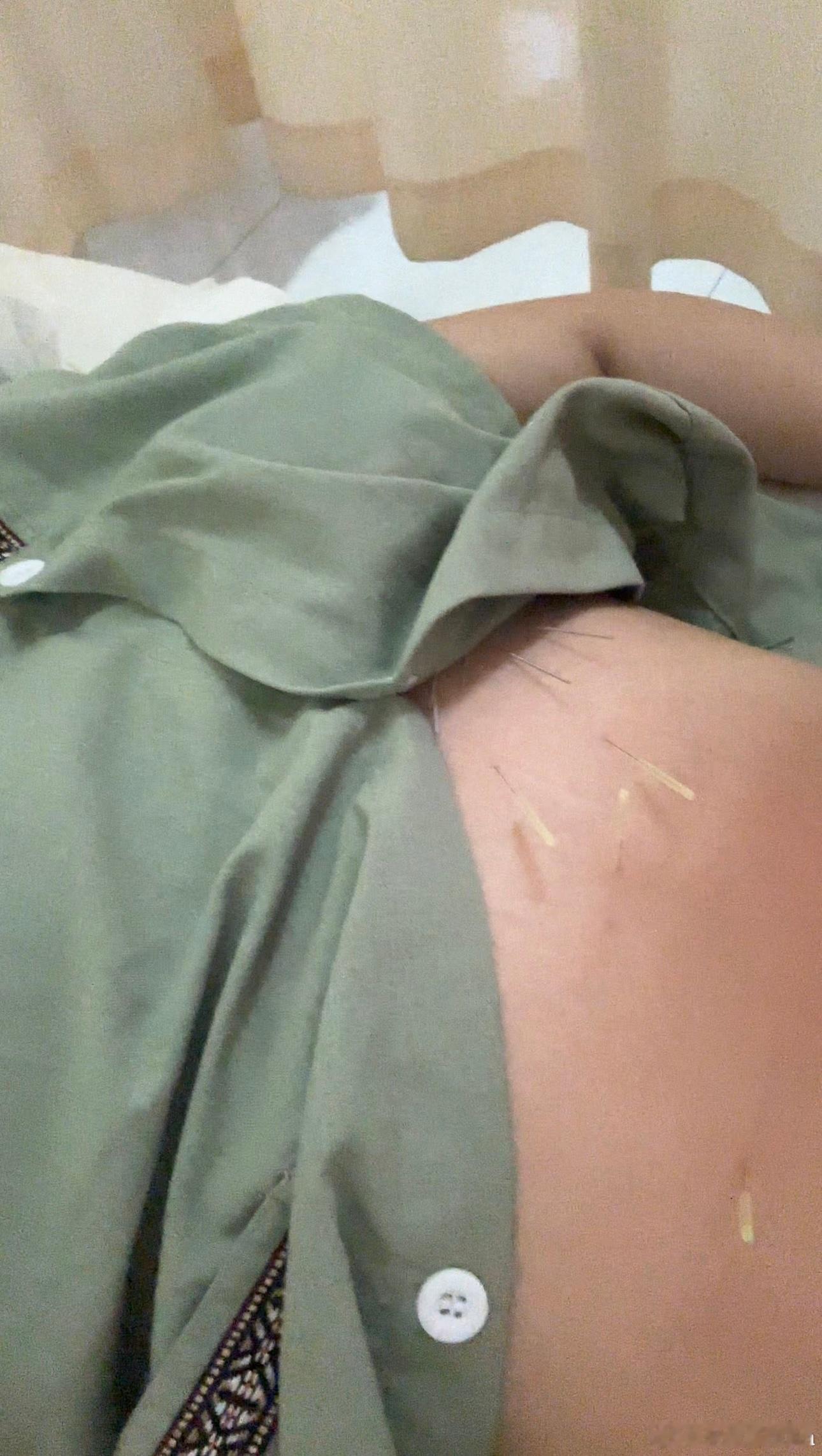 《养伤记》一场降温，晨起沐浴后的寒意，竟引来了缠人一月有余的背痛，也让我彻底按下