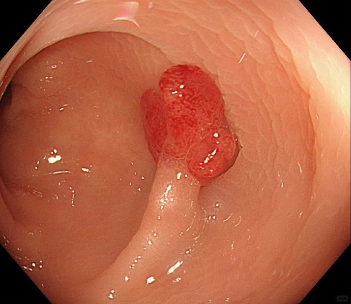 感觉这才是女生最需要知道的女性冷知识 
