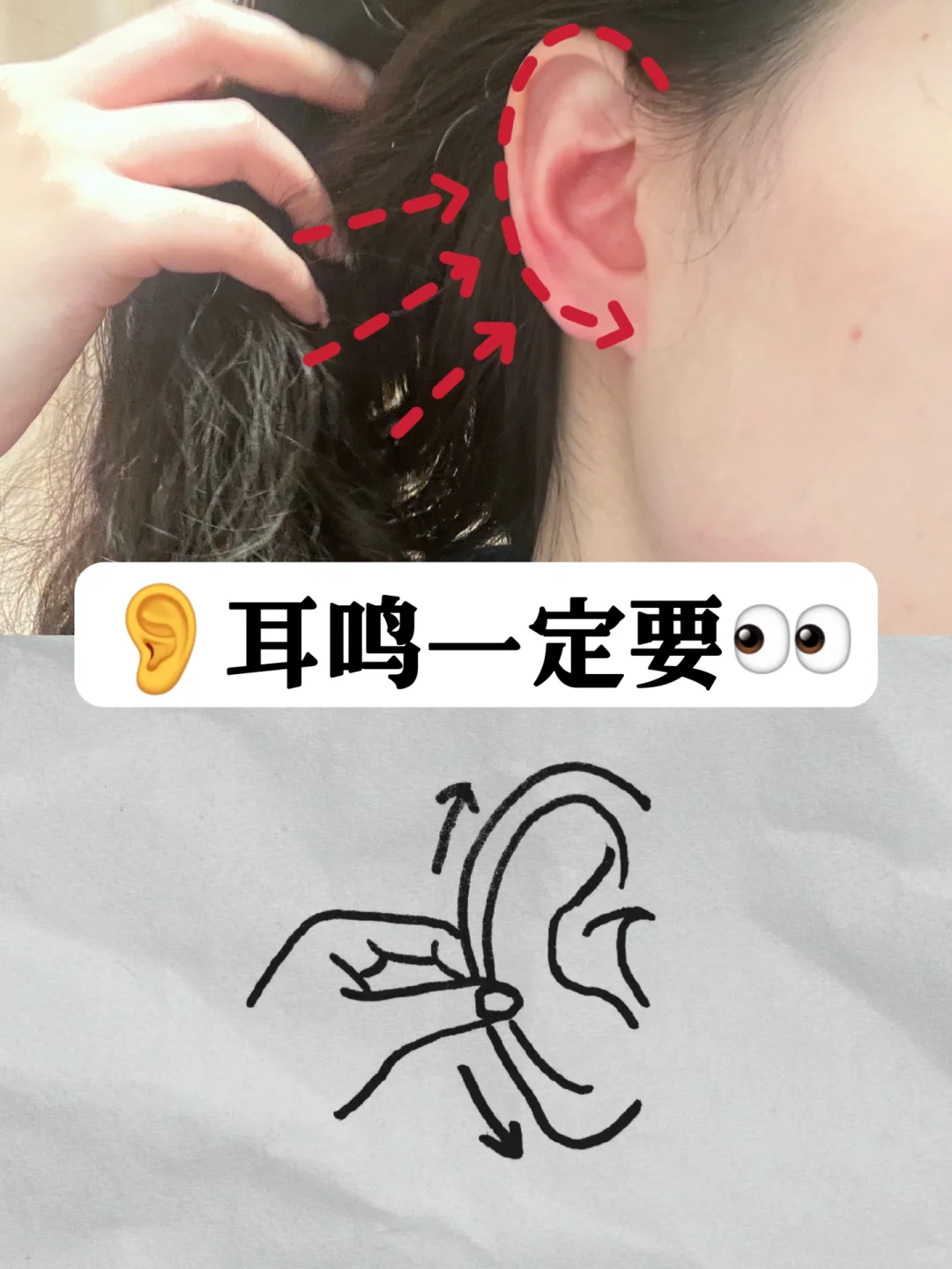 重度耳鸣快去试！这法子真的太狠了！