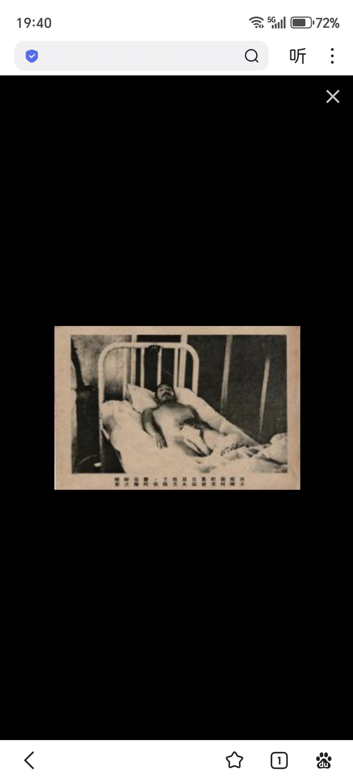 这名被严重烧伤的何姓老农家住南京秣陵关，此时正在鼓楼医院接受治疗。美国医生在日记