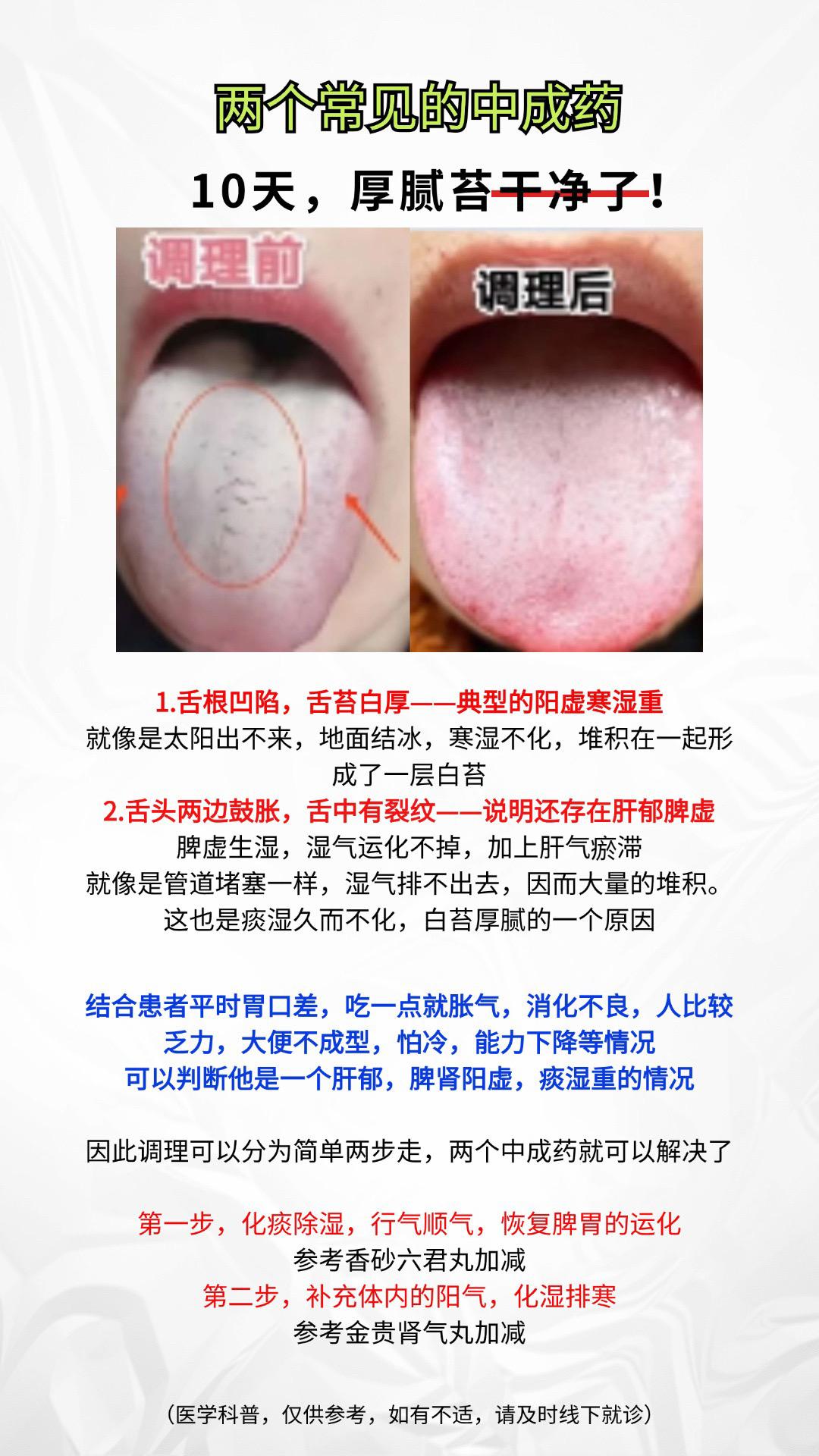 #中医 #舌诊