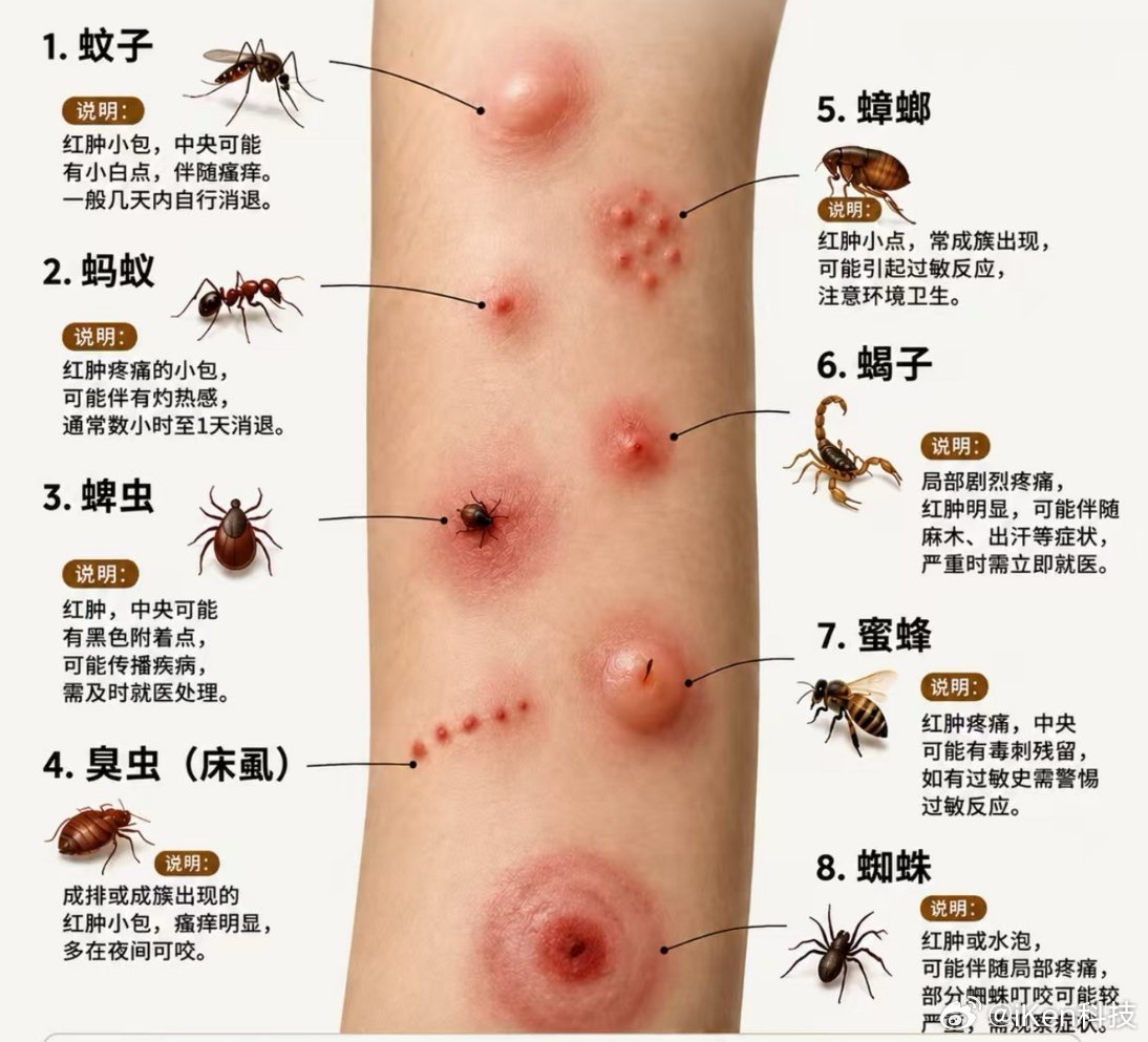 女子被蜱虫咬伤住ICU28天四肢瘫痪虫子们简直太可恶了！而且被虫咬好危险[闭嘴]
