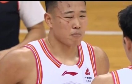 好家伙，贺希宁这面部伤痕，真像刚打过架。其实CBA的动作强度比NBA要大的…cb
