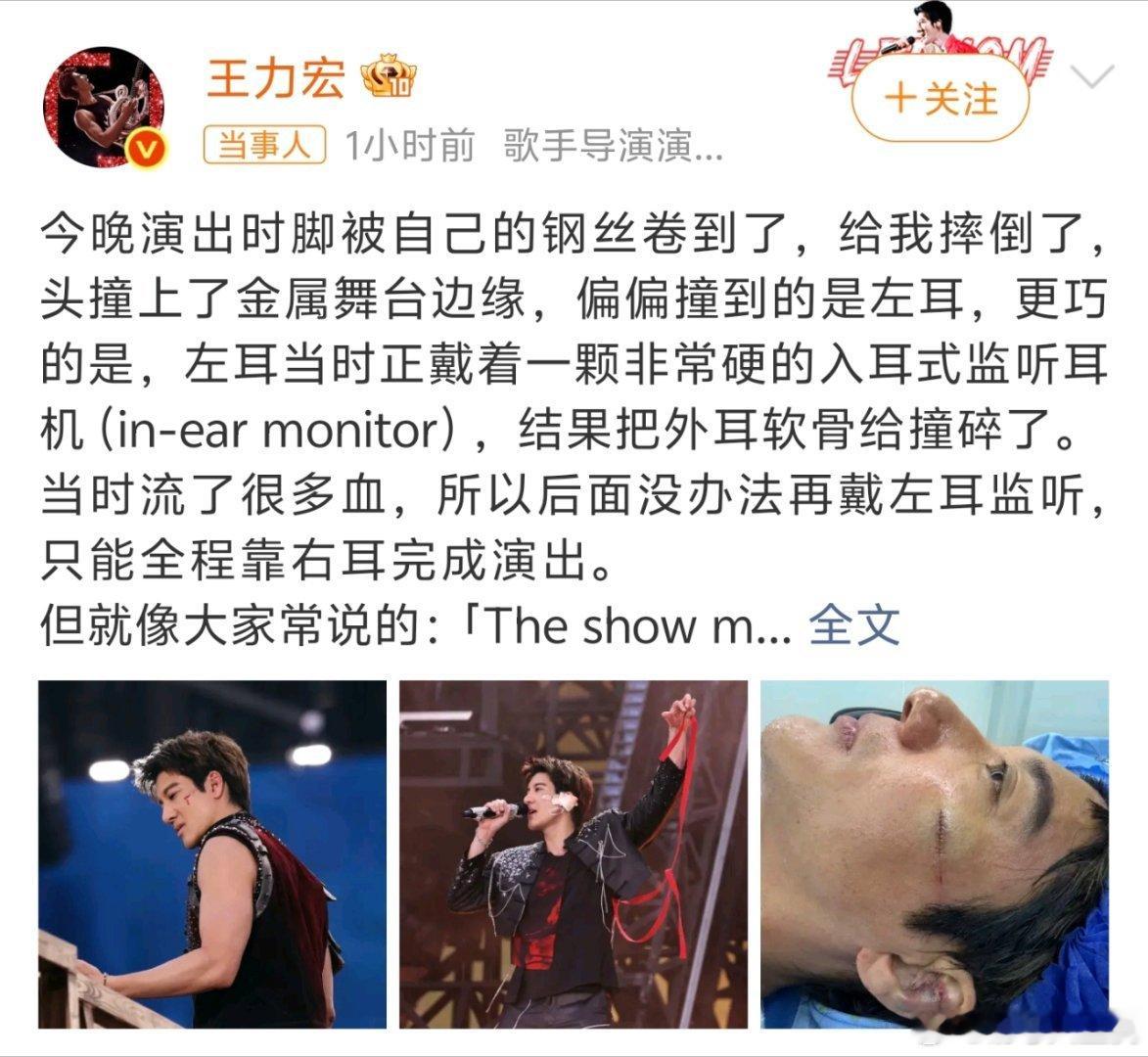 王力宏缝了39针挺严重了，老辈子是真敬业！再有就是这个工作室得换人了吧？