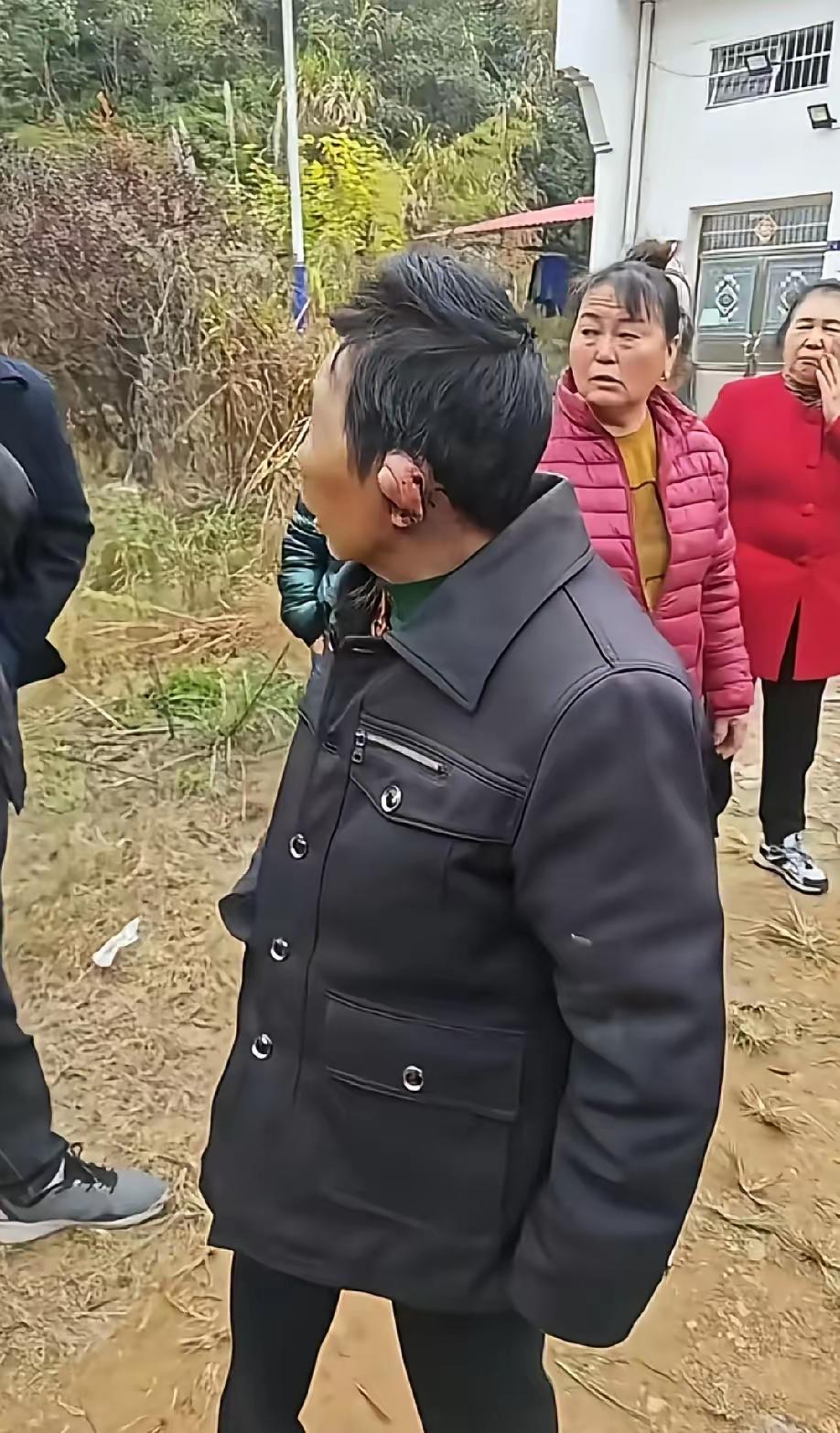 可怜的女人，被自己的男人家暴的面目全非，耳朵都被D变了形，脸上更是伤痕累累。
