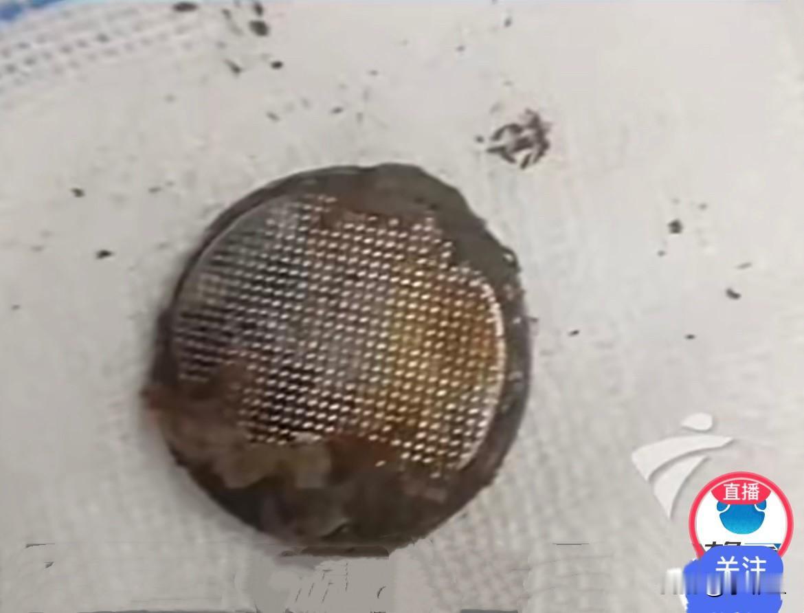 近日，广东阳江一名仅16个月大的女婴突然出现频繁呕吐的情况，孩子小不会说话，只能