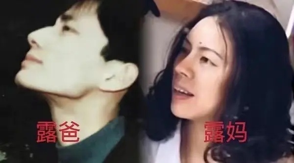 赵露思现在是在试图用她爸妈的照片证明她没有动脸吗 ​​​
