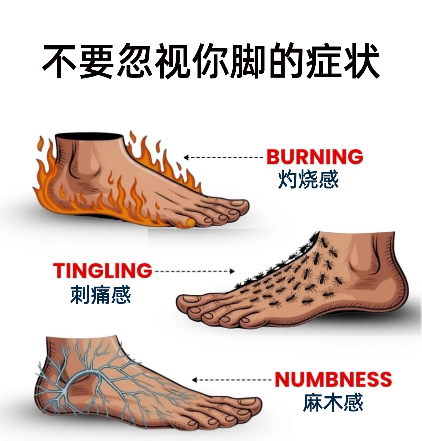 足踝康复 你的双脚是健康的基础，当它们发出信号时，不要忽视这些迹象——尤其是灼烧